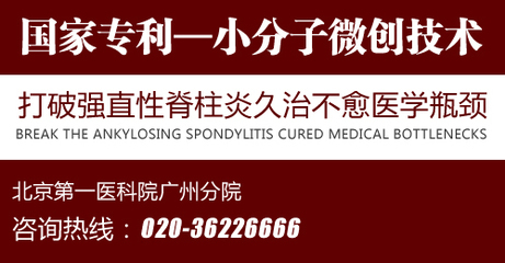 治疗强直性脊柱炎去广州医院哪家好 - 健康养生 - 昆明信息网-大众养生